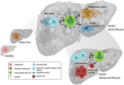 Revisiting the Role of Natural Killer Cells in Non-Alcoholic Fatty Liver Disease